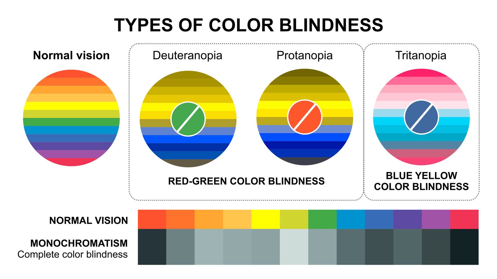 Types of Color Blindness Test Illustration